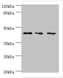 Western blot | All lanes: CHI3L2 antibody at 4μg/ml | Lane 1: Hela whole cell lysate | Lane 2: Rat brain tissue | Lane 3: A431 whole cell lysate | Secondary | Goat polyclonal to rabbit IgG at 1/10000 dilution | Predicted band size: 44, 35, 43 kDa | Observed band size: 44 kDaRabbit anti-Human CHI3L2 Polyclonal Antibody