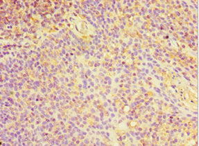 Immunohistochemistry of paraffin-embedded human tonsil tissue using CHI3L2 Antibody at dilution of 1:100Rabbit anti-Human CHI3L2 Polyclonal Antibody