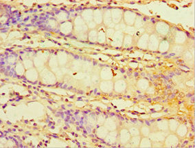 Immunohistochemistry of paraffin-embedded human colon tissue using CHI3L2 Antibody at dilution of 1:100Rabbit anti-Human CHI3L2 Polyclonal Antibody