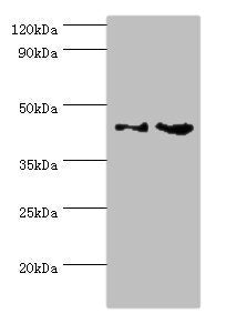 Western blot | All lanes: CHI3L2 antibody at 4μg/ml | Lane 1: Rat brain tissue | Lane 2: A431 whole cell lysate | Secondary | Goat polyclonal to rabbit IgG at 1/10000 dilution | Predicted band size: 44, 35, 43 kDa | Observed band size: 44 kDaRabbit anti-Human CHI3L2 Polyclonal Antibody