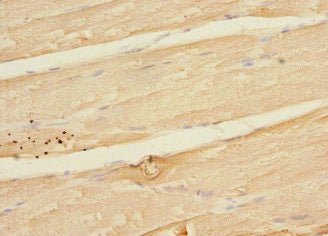 Immunohistochemistry of paraffin-embedded human skeletal muscle tissue using MAPKAPK3 Antibody at dilution of 1:100