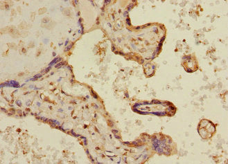 Immunohistochemistry of paraffin-embedded human placenta tissue using MAPKAPK3 Antibody at dilution of 1:100