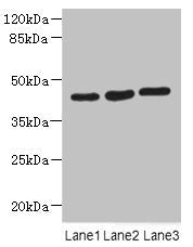 Western blot  | All lanes: MAPKAPK3 antibody at 4.4µg/ml  | Lane 1: Hela whole cell lysate  | Lane 2: Jurkat whole cell lysate  | Lane 3: MCF-7 whole cell lysate  | Secondary  | Goat polyclonal to rabbit IgG at 1/10000 dilution  | Predicted band size: 43 kDa  | Observed band size: 43 kDa