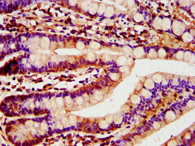 IHC image of TST Antibody diluted at 1:400 and staining in paraffin-embedded human small intestine tissue performed on a Leica BondTM system. After dewaxing and hydration, antigen retrieval was mediated by high pressure in a citrate buffer (pH 6.0). Section was blocked with 10% normal goat serum 30min at RT. Then primary antibody (1% BSA) was incubated at 4°C overnight. The primary is detected by a biotinylated secondary antibody and visualized using an HRP conjugated SP system.Rabbit anti-Human TST Polyclonal Antibody