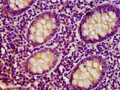 IHC image of TST Antibody diluted at 1:400 and staining in paraffin-embedded human appendix tissue performed on a Leica BondTM system. After dewaxing and hydration, antigen retrieval was mediated by high pressure in a citrate buffer (pH 6.0). Section was blocked with 10% normal goat serum 30min at RT. Then primary antibody (1% BSA) was incubated at 4°C overnight. The primary is detected by a biotinylated secondary antibody and visualized using an HRP conjugated SP system.Rabbit anti-Human TST Polyclonal Antibody