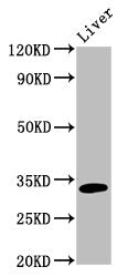 Western Blot | Positive WB detected in: Rat liver tissue | All lanes: TST antibody at 5μg/ml | Secondary | Goat polyclonal to rabbit IgG at 1/50000 dilution | Predicted band size: 34 kDa | Observed band size: 34 kDaRabbit anti-Human TST Polyclonal Antibody