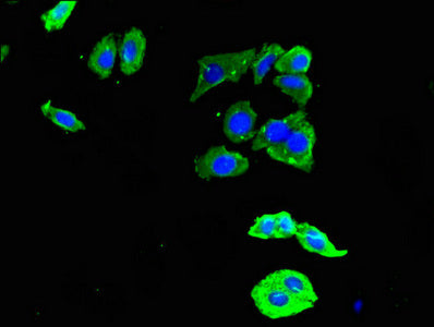 Immunofluorescent analysis of HepG2 cells using DDR2 Antibody at dilution of 1:100 and Alexa Fluor 488-congugated AffiniPure Goat Anti-Rabbit IgG(H+L)Rabbit anti-Human DDR2 Polyclonal Antibody