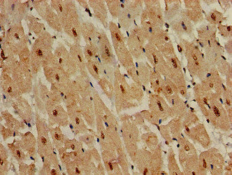 Immunohistochemistry of paraffin-embedded human heart tissue using DDR2 Antibody at dilution of 1:100Rabbit anti-Human DDR2 Polyclonal Antibody