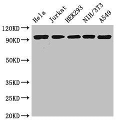 Western Blot | Positive WB detected in: Hela whole cell lysate, Jurkat whole cell lysate, HEK293 whole cell lysate, NIH/3T3 whole cell lysate, A549 whole cell lysate | All lanes: DDR2 antibody at 3.5μg/ml | Secondary | Goat polyclonal to rabbit IgG at 1/50000 dilution | Predicted band size: 97 kDa | Observed band size: 97 kDaRabbit anti-Human DDR2 Polyclonal Antibody