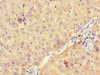 Immunohistochemistry of paraffin-embedded human liver tissue using UGP2 Antibody at dilution of 1:100Rabbit anti-Human UGP2 Polyclonal Antibody