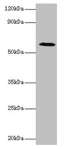 Western blot  | All lanes: UGP2 antibody at 2µg/ml + Mouse liver tissue  | Secondary  | Goat polyclonal to rabbit IgG at 1/10000 dilution  | Predicted band size: 57, 56 kDa  | Observed band size: 57 kDaRabbit anti-Human UGP2 Polyclonal Antibody