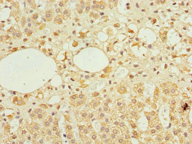 Immunohistochemistry of paraffin-embedded human adrenal gland tissue using TFCP2 Antibody at dilution of 1:100Rabbit anti-Human TFCP2 Polyclonal Antibody