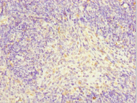 Immunohistochemistry of paraffin-embedded human thymus tissue using TFCP2 Antibody at dilution of 1:100Rabbit anti-Human TFCP2 Polyclonal Antibody