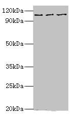Western blot | All lanes: MERTK antibody at 10μg/ml | Lane 1: Mouse gonad tissue | Lane 2: Mouse lung tissue | Lane 3: Mouse kidney tissue | Secondary | Goat polyclonal to rabbit IgG at 1/10000 dilution | Predicted band size: 110 kDa | Observed band size: 110 kDa