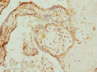 Immunohistochemistry of paraffin-embedded human placenta tissue using COX10 Antibody at dilution of 1:100Rabbit anti-Human COX10 Polyclonal Antibody