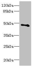 Western blot | All lanes: COX10 antibody at 5.31μg/ml + Mouse gonadal tissue | Secondary | Goat polyclonal to rabbit IgG at 1/10000 dilution | Predicted band size: 49, 28 kDa | Observed band size: 49 kDaRabbit anti-Human COX10 Polyclonal Antibody