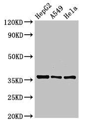 Western Blot | Positive WB detected in: HepG2 whole cell lysate, A549 whole cell lysate, Hela whole cell lysate | All lanes: ECH1 antibody at 2.5μg/ml | Secondary | Goat polyclonal to rabbit IgG at 1/50000 dilution | Predicted band size: 36 kDa | Observed band size: 36 kDaRabbit anti-Human ECH1 Polyclonal Antibody