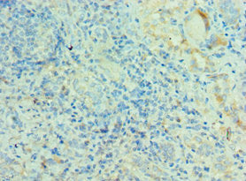 Immunohistochemistry of paraffin-embedded human kidney tissue using MRPL28 Antibody at dilution of 1:100