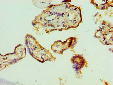 Immunohistochemistry of paraffin-embedded human placenta tissue using TARDBP Antibody at dilution of 1:100Rabbit anti-Human TARDBP Polyclonal Antibody