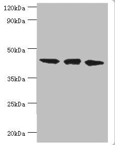 Western blot | All lanes: TAR DNA-binding protein 43 antibody at 8μg/ml | Lane 1: Hela whole cell lysate | Lane 2: Mouse spleen tissue | Lane: K562 whole cell lysate | Secondary | Goat polyclonal to rabbit IgG at 1/10000 dilution | Predicted band size: 45, 32 kDa | Observed band size: 45 kDaRabbit anti-Human TARDBP Polyclonal Antibody