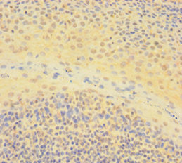 Immunohistochemistry of paraffin-embedded human tonsil tissue using IKZF1 Antibody at dilution of 1:100Rabbit anti-Human IKZF1 Polyclonal Antibody