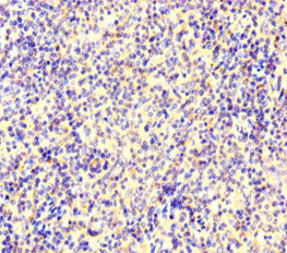 Immunohistochemistry of paraffin-embedded human spleen tissue using IKZF1 Antibody at dilution of 1:100Rabbit anti-Human IKZF1 Polyclonal Antibody