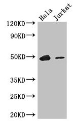 Western Blot | Positive WB detected in: Hela whole cell lysate, Jurkat whole cell lysate | All lanes: IKZF1 antibody at 3.4μg/ml | Secondary | Goat polyclonal to rabbit IgG at 1/50000 dilution | Predicted band size: 58, 49, 48, 44, 42, 32, 53, 25 kDa | Observed band size: 49 kDa