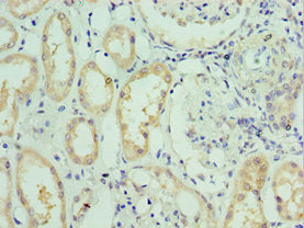 Immunohistochemistry of paraffin-embedded human kidney tissue using SLC39A6 Antibody at dilution of 1:100Rabbit anti-Human SLC39A6 Polyclonal Antibody