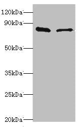 Western blot | All lanes: SLC39A6 antibody at 10μg/ml | Lane 1: Hela whole cell lysate | Lane 2: 293T whole cell lysate | Secondary | Goat polyclonal to rabbit IgG at 1/10000 dilution | Predicted band size: 86, 49 kDa | Observed band size: 86 kDaRabbit anti-Human SLC39A6 Polyclonal Antibody