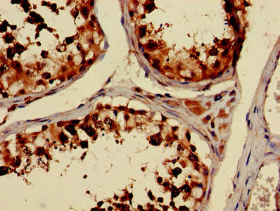 Immunohistochemistry of paraffin-embedded human testis tissue using TUBA3C Antibody at dilution of 1:100Rabbit anti-Human TUBA3C Polyclonal Antibody