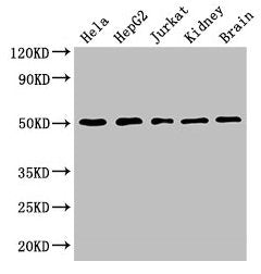 Western Blot  | Positive WB detected in: Hela whole cell lysate, HepG2 whole cell lysate, Jurkat whole cell lysate, Mouse kidney tissue, Mouse brain tissue  | All lanes: TUBA3C antibody at 3µg/ml  | Secondary  | Goat polyclonal to rabbit IgG at 1/50000 dilution  | Predicted band size: 50, 47 kDa  | Observed band size: 50 kDaRabbit anti-Human TUBA3C Polyclonal Antibody