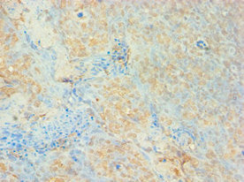 Immunohistochemistry of paraffin-embedded human tonsil tissue using AUH Antibody at dilution of 1: 100