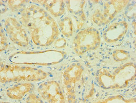 Immunohistochemistry of paraffin-embedded human kidney tissue using AUH Antibody at dilution of 1: 100