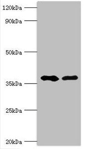Western blot | All lanes: Methylglutaconyl-CoA hydratase, mitochondrial antibody at 6μg/ml | Lane 1: Rat brain tissue | Lane 2: Rat kidney tissue | Secondary | Goat polyclonal to rabbit IgG at 1/10000 dilution | Predicted band size: 36, 33 kDa | Observed band size: 36 kDa