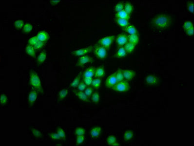 Immunofluorescence staining of PC-3 cells with KCNC3 Antibody at 1:100, counter-stained with DAPI. The cells were fixed in 4% formaldehyde, permeabilized using 0.2% Triton X-100 and blocked in 10% normal Goat Serum. The cells were then incubated with the antibody overnight at 4°C. The secondary antibody was Alexa Fluor 488-congugated AffiniPure Goat Anti-Rabbit IgG(H+L).