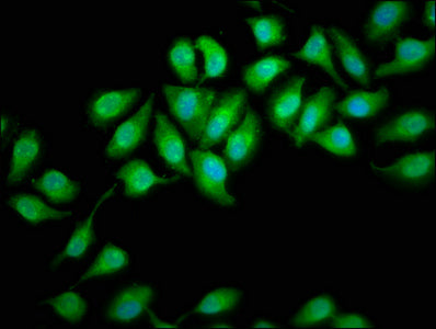 Immunofluorescence staining of A549 cells with DHX34 Antibody at 1:166, counter-stained with DAPI. The cells were fixed in 4% formaldehyde, permeabilized using 0.2% Triton X-100 and blocked in 10% normal Goat Serum. The cells were then incubated with the antibody overnight at 4°C. The secondary antibody was Alexa Fluor 488-congugated AffiniPure Goat Anti-Rabbit IgG(H+L).Rabbit anti-Human DHX34 Polyclonal Antibody