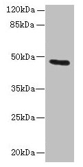 Western blot  | All lanes: KRT33B antibody at 1µg/ml + MCF-7 whole cell lysate  | Secondary  | Goat polyclonal to rabbit IgG at 1/10000 dilution  | Predicted band size: 47 kDa  | Observed band size: 47 kDa