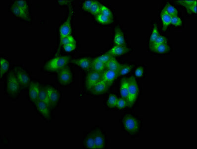 Immunofluorescence staining of HepG2 cells with LAPTM4A Antibody at 1:100, counter-stained with DAPI. The cells were fixed in 4% formaldehyde, permeabilized using 0.2% Triton X-100 and blocked in 10% normal Goat Serum. The cells were then incubated with the antibody overnight at 4°C. The secondary antibody was Alexa Fluor 488-congugated AffiniPure Goat Anti-Rabbit IgG(H+L).Rabbit anti-Human LAPTM4A Polyclonal Antibody