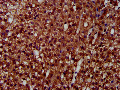 IHC image of the antibody diluted at 1:300 and staining in paraffin-embedded human adrenal gland tissue performed on a Leica BondTM system. After dewaxing and hydration, antigen retrieval was mediated by high pressure in a citrate buffer (pH 6.0). Section was blocked with 10% normal goat serum 30min at RT. Then primary antibody (1% BSA) was incubated at 4°C overnight. The primary is detected by a biotinylated secondary antibody and visualized using an HRP conjugated SP system.