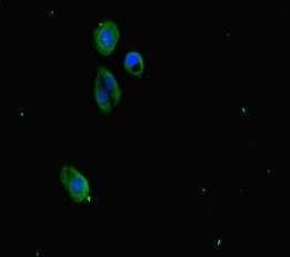 Immunofluorescence staining of HepG2 cells with SUZ12 Antibody at 1:333, counter-stained with DAPI. The cells were fixed in 4% formaldehyde, permeabilized using 0.2% Triton X-100 and blocked in 10% normal Goat Serum. The cells were then incubated with the antibody overnight at 4°C. The secondary antibody was Alexa Fluor 488-congugated AffiniPure Goat Anti-Rabbit IgG(H+L).