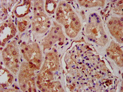 IHC image of SUZ12 Antibody diluted at 1:1000 and staining in paraffin-embedded human kidney tissue performed on a Leica BondTM system. After dewaxing and hydration, antigen retrieval was mediated by high pressure in a citrate buffer (pH 6.0). Section was blocked with 10% normal goat serum 30min at RT. Then primary antibody (1% BSA) was incubated at 4°C overnight. The primary is detected by a biotinylated secondary antibody and visualized using an HRP conjugated SP system.