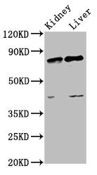 Western Blot | Positive WB detected in: Rat kidney tissue, Rat liver tissue | All lanes: SUZ12 antibody at 3.4μg/ml | Secondary | Goat polyclonal to rabbit IgG at 1/50000 dilution | Predicted band size: 84 kDa | Observed band size: 84 kDa