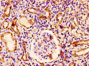 IHC image of RAB3GAP1 Antibody diluted at 1:300 and staining in paraffin-embedded human kidney tissue performed on a Leica BondTM system. After dewaxing and hydration, antigen retrieval was mediated by high pressure in a citrate buffer (pH 6.0). Section was blocked with 10% normal goat serum 30min at RT. Then primary antibody (1% BSA) was incubated at 4°C overnight. The primary is detected by a biotinylated secondary antibody and visualized using an HRP conjugated SP system.Rabbit anti-Human RAB3GAP1 Polyclonal Antibody