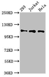 Western Blot  | Positive WB detected in: 293 whole cell lysate, Jurkat whole cell lysate, Hela whole cell lysate  | All lanes: RAB3GAP1 antibody at 7µg/ml  | Secondary  | Goat polyclonal to rabbit IgG at 1/50000 dilution  | Predicted band size: 111, 112, 106 kDa  | Observed band size: 111 kDaRabbit anti-Human RAB3GAP1 Polyclonal Antibody