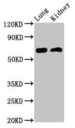 Western Blot | Positive WB detected in: Rat lung tissue, Mouse kidney tissue | All lanes: IQCB1 antibody at 3.2μg/ml | Secondary | Goat polyclonal to rabbit IgG at 1/50000 dilution | Predicted band size: 69, 54, 35 kDa | Observed band size: 69 kDa