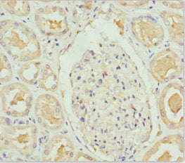 Immunohistochemistry of paraffin-embedded human kidney tissue using PEA15 Antibody at dilution of 1:100Rabbit anti-Human PEA15 Polyclonal Antibody