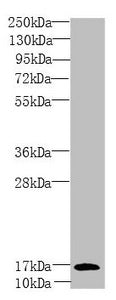 Western blot | All lanes: PEA15 antibody at 1.81 μg/ml + Mouse brain tissue | Secondary | Goat polyclonal to rabbit IgG at 1/10000 dilution | Predicted band size: 16, 18 kDa | Observed band size: 16 kDaRabbit anti-Human PEA15 Polyclonal Antibody