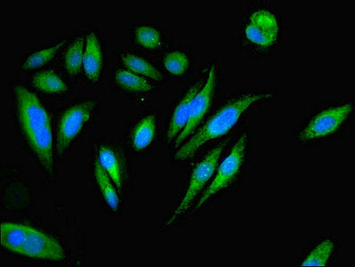 Immunofluorescent analysis of Hela cells using PEA15 Antibody at dilution of 1:100 and Alexa Fluor 488-congugated AffiniPure Goat Anti-Rabbit IgG(H+L)Rabbit anti-Human PEA15 Polyclonal Antibody