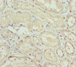 Immunohistochemistry of paraffin-embedded human kidney tissue using PEA15 Antibody at dilution of 1:100Rabbit anti-Human PEA15 Polyclonal Antibody