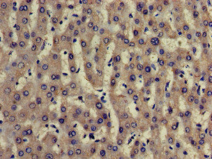 Immunohistochemistry of paraffin-embedded human liver tissue using TRADD Antibody at dilution of 1:100Rabbit anti-Human TRADD Polyclonal Antibody